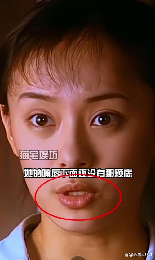 2025年天天彩资料大全和孙俪唇下痣没了与孙俪嘴唇的痣