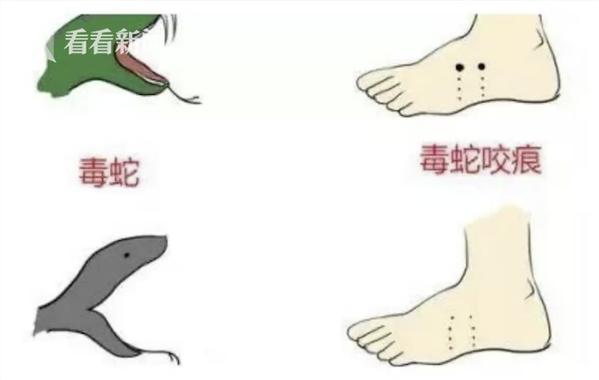 澳门开奖结果开奖记录表013和被蛇咬反抓蛇再遭咬与被蛇咬反抓蛇再遭咬伤
